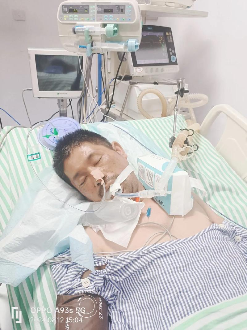 脑干出血程序员发声,脑干出血死亡过程视频